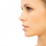 Juvederm