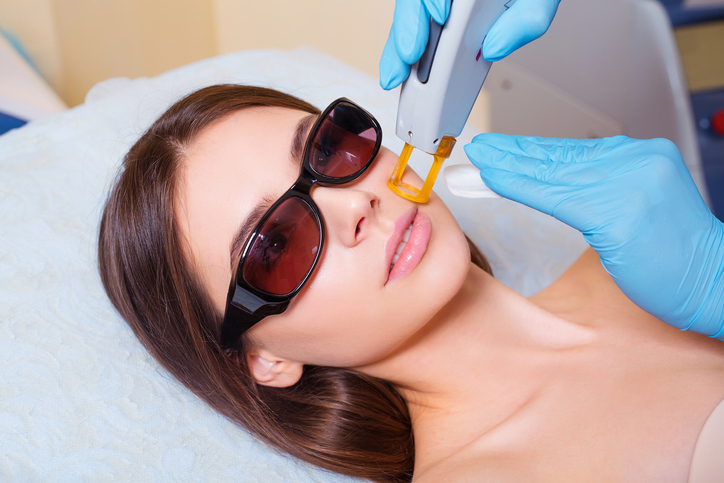 IPL Photofacial services Beverly Hills, CA/IPL Photofacial Beverly Hills, CA